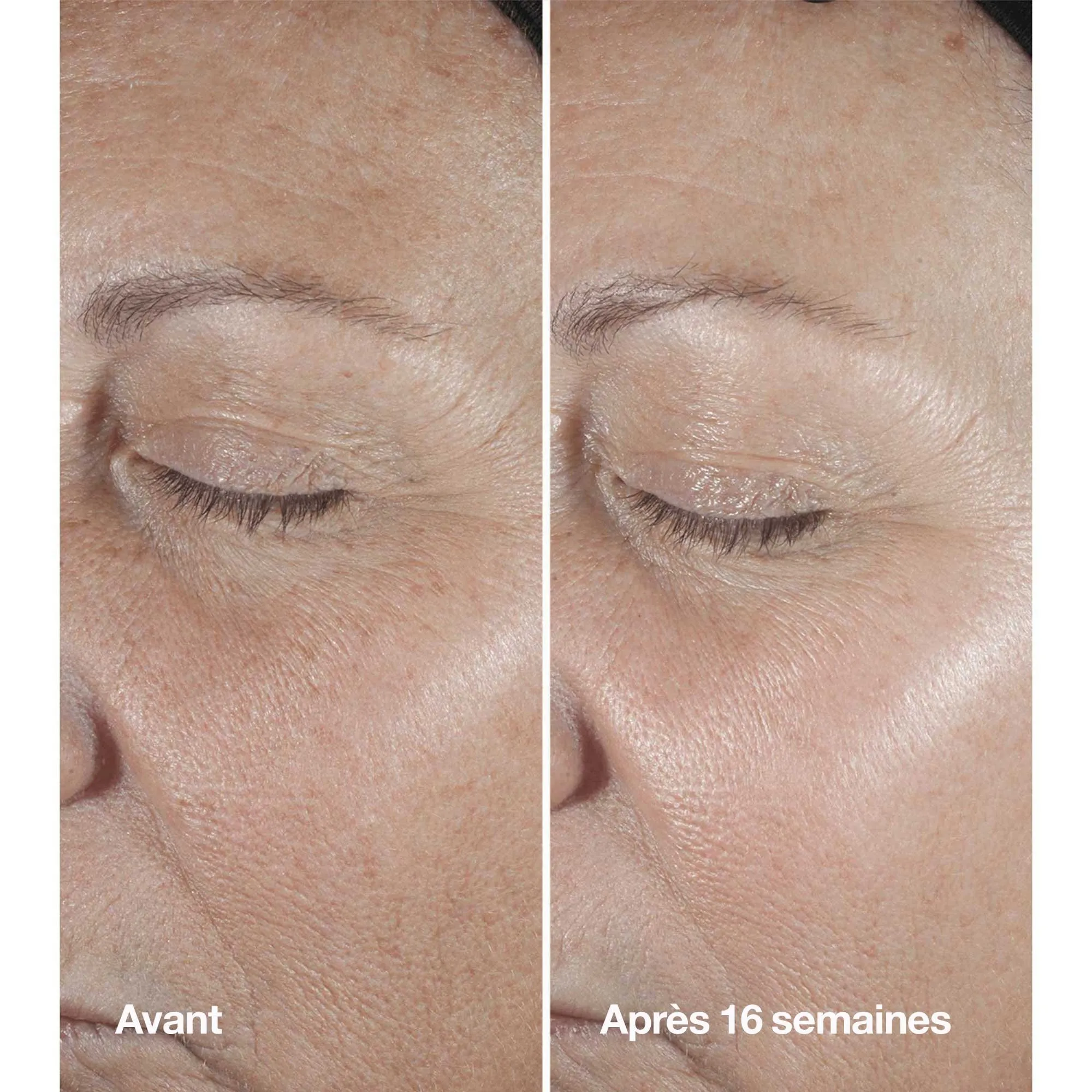 CLINIQUE CLINIQUE SMART CLINICAL SERUM  SéRUM CORRECTOR ANTIARRUGAS