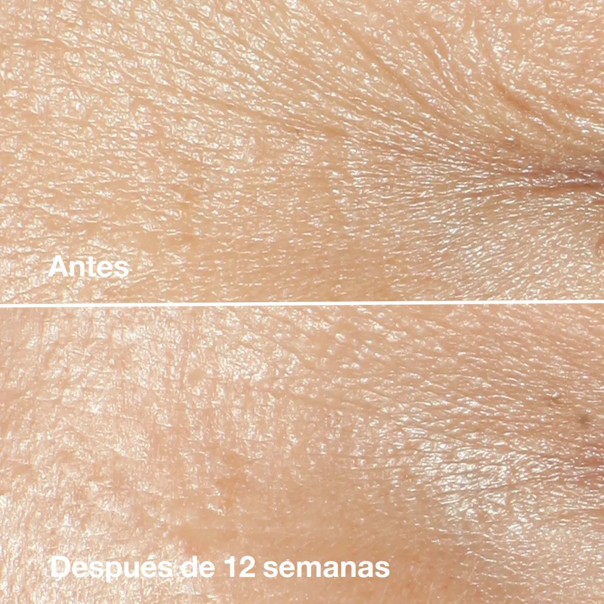 Crema Hidratante Smart Clinical Repair Antiarrugas